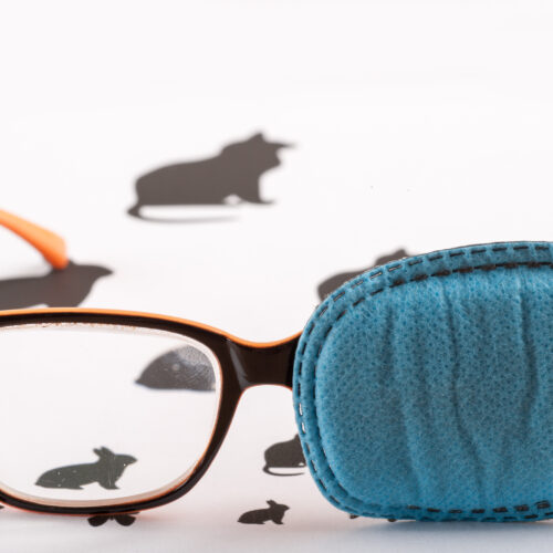 Deon Hattingh Optometrist, Vision Therapy, Norwood, Johannesburg, eye teaming, squint eyes, sport vision training, concussion management