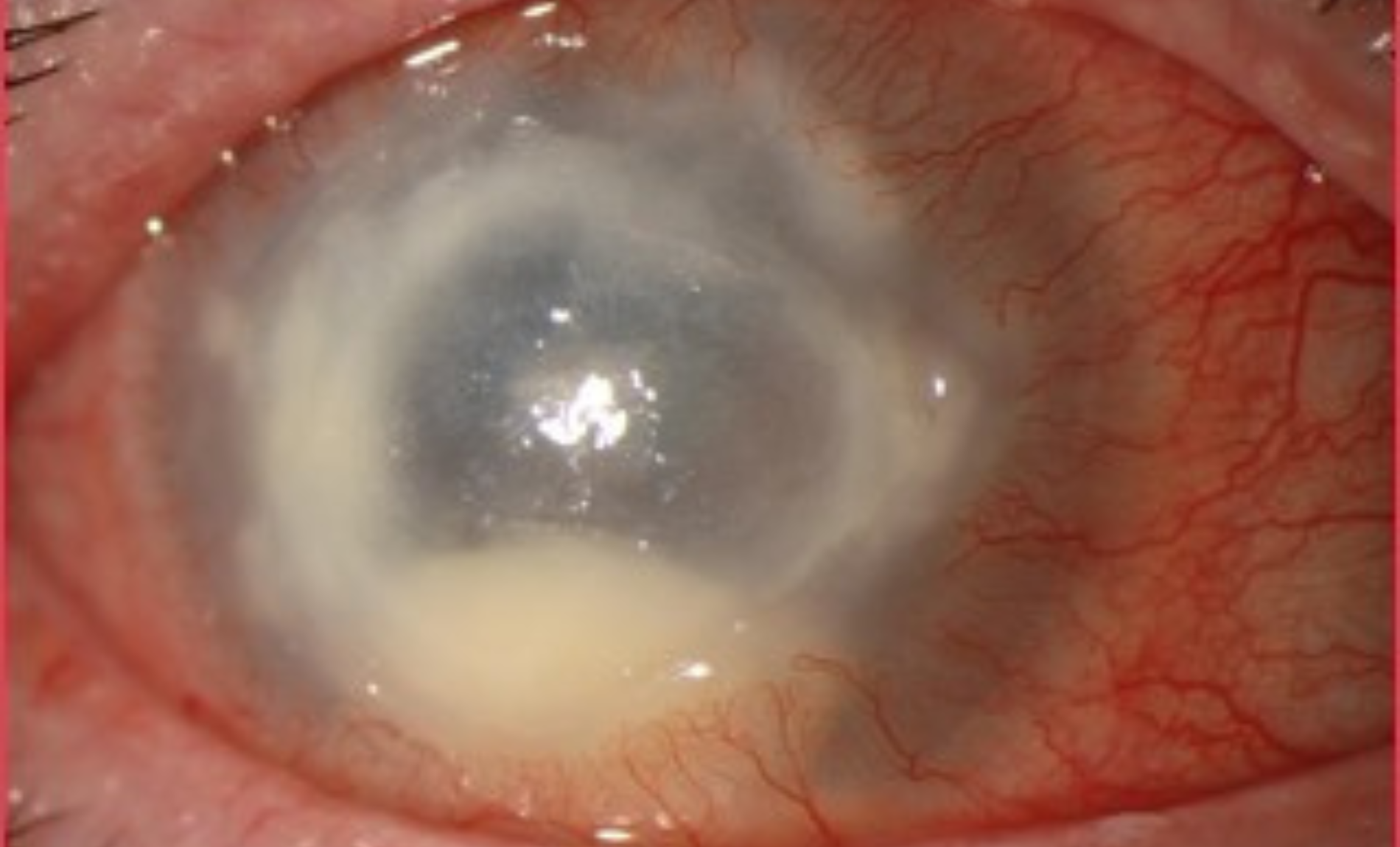 scary image of an eyeball scary image of an eyeball